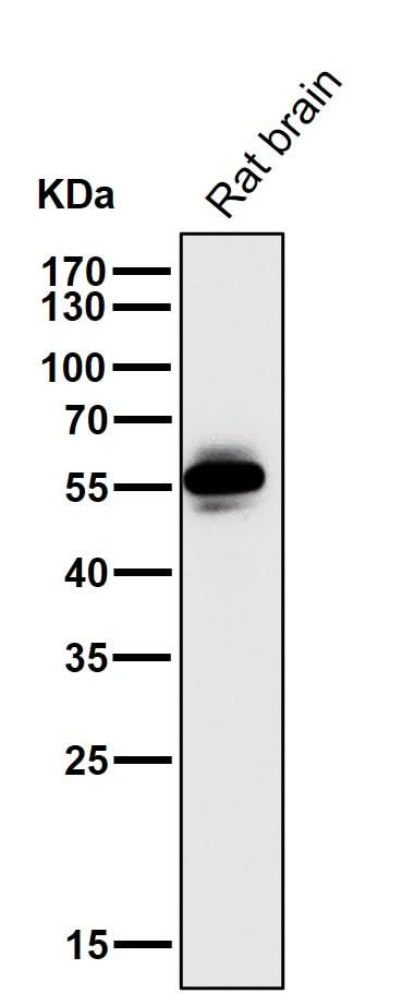 Anti-CaMKII CAMK2B Rabbit Monoclonal Antibody Boster Bio