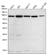 Anti-WASF2 Rabbit Monoclonal Antibody Boster Bio
