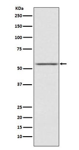 Anti-AMHR2 Rabbit Monoclonal Antibody Boster Bio