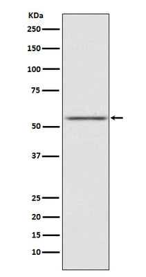 Anti-AMHR2 Rabbit Monoclonal Antibody Boster Bio