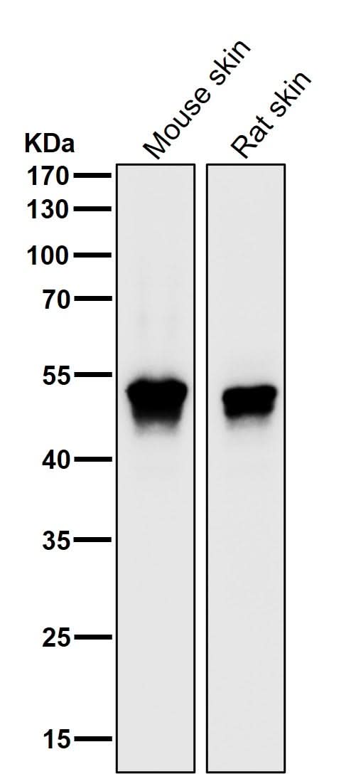 Anti-MEK5 Rabbit Monoclonal Antibody Boster Bio