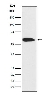 Anti-Cytokeratin 6 Rabbit Monoclonal Antibody Boster Bio