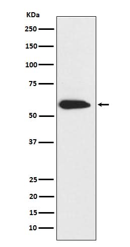 Anti-Cytokeratin 6 Rabbit Monoclonal Antibody Boster Bio