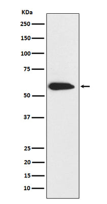 Anti-Cytokeratin 6 Rabbit Monoclonal Antibody Boster Bio