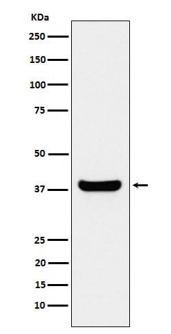 Anti-Protein Phosphatase 1 beta Rabbit Monoclonal Antibody Boster Bio
