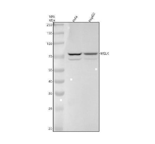 Anti-MELK Rabbit Monoclonal Antibody Boster Bio