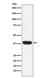 Anti-MYF5 Rabbit Monoclonal Antibody Boster Bio