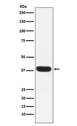 Anti-MYF5 Rabbit Monoclonal Antibody Boster Bio