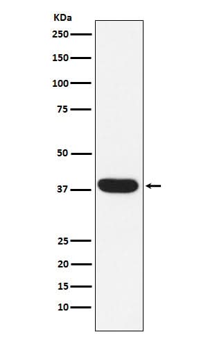 Anti-MYF5 Rabbit Monoclonal Antibody Boster Bio