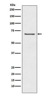 Anti-GABA A Receptor beta 2 Rabbit Monoclonal Antibody Boster Bio