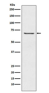 Anti-GABA A Receptor beta 2 Rabbit Monoclonal Antibody Boster Bio