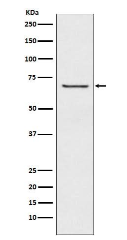 Anti-GABA A Receptor beta 2 Rabbit Monoclonal Antibody Boster Bio