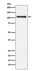 Anti-Protein Kinase D2 Rabbit Monoclonal Antibody Boster Bio