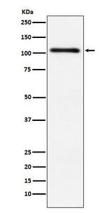 Anti-Protein Kinase D2 Rabbit Monoclonal Antibody Boster Bio