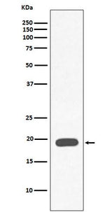 Anti-Myoglobin MB Rabbit Monoclonal Antibody Boster Bio