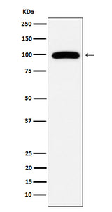 Anti-CD10 MME Monoclonal Antibody Boster Bio