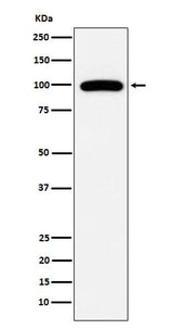 Anti-CD10 MME Monoclonal Antibody Boster Bio