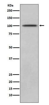 Anti-CD10 MME Rabbit Monoclonal Antibody Boster Bio