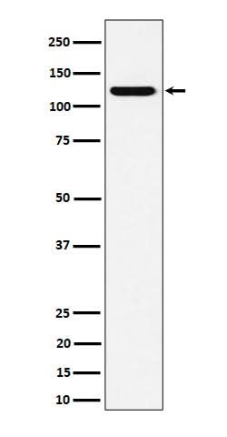 Anti-PKN2 Rabbit Monoclonal Antibody Boster Bio