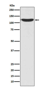 Anti-PKN2/Prk2 Rabbit Monoclonal Antibody Boster Bio