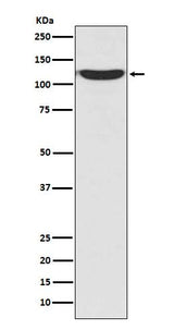 Anti-PKN2/Prk2 Rabbit Monoclonal Antibody Boster Bio