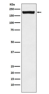 Anti-MRC2/ENDO180 Rabbit Monoclonal Antibody Boster Bio