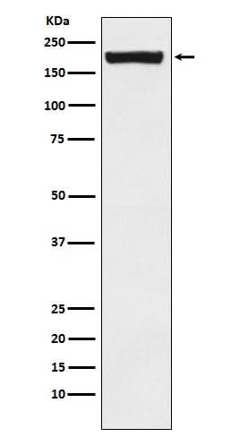 Anti-MRC2/ENDO180 Rabbit Monoclonal Antibody Boster Bio