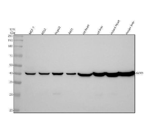 Anti-Aspartate Aminotransferase Monoclonal Antibody Boster Bio