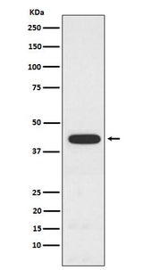 Anti-PCYT1A Rabbit Monoclonal Antibody Boster Bio