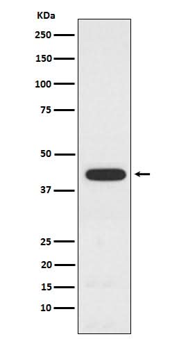 Anti-PCYT1A Rabbit Monoclonal Antibody Boster Bio