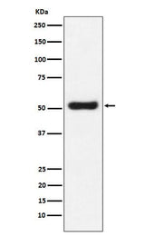 Anti-OLFM4 Monoclonal Antibody Boster Bio