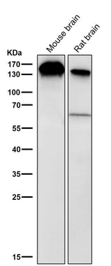 Anti-BTF Rabbit Monoclonal Antibody Boster Bio