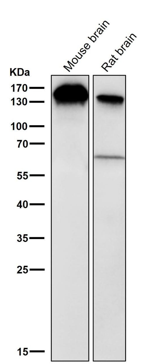 Anti-BTF Rabbit Monoclonal Antibody Boster Bio
