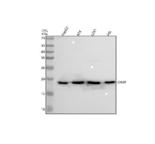 Anti-CIRBP Rabbit Monoclonal Antibody Boster Bio