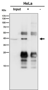 Anti-SLP2 Rabbit Monoclonal Antibody Boster Bio