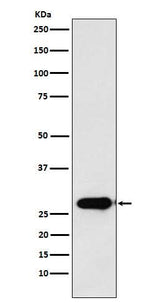 Anti-Calpain S1 Rabbit Monoclonal Antibody Boster Bio