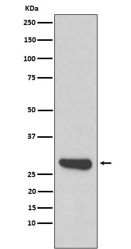 Anti-Calpain small subunit 1 Rabbit Monoclonal Antibody Boster Bio