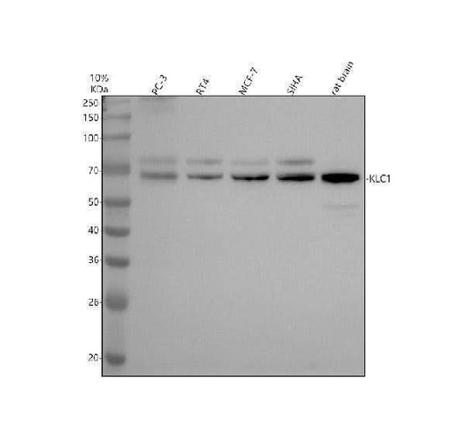 Anti-KLC1 Rabbit Monoclonal Antibody Boster Bio