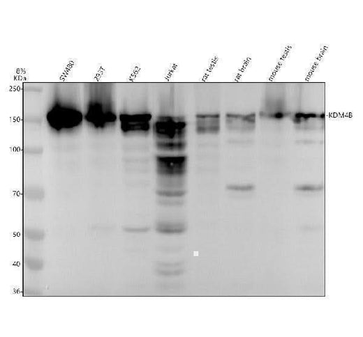 Anti-KDM4B / JMJD2B Rabbit Monoclonal Antibody Boster Bio