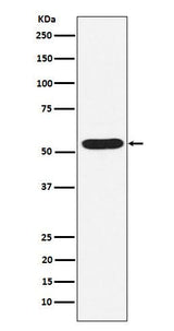 Anti-PIAS2 Rabbit Monoclonal Antibody Boster Bio