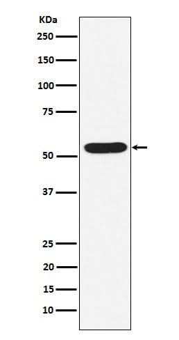 Anti-PIAS2 Rabbit Monoclonal Antibody Boster Bio