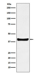 Anti-p40 Rabbit Monoclonal Antibody Boster Bio