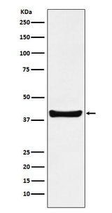 Anti-p40 Rabbit Monoclonal Antibody Boster Bio
