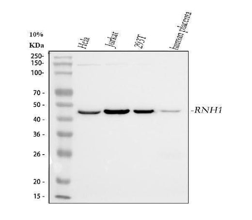 Anti-Ribonuclease Inhibitor/RNH1 Antibody Picoband® (monoclonal, 4F3 Boster Bio