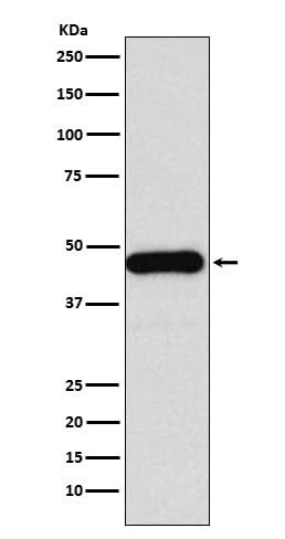 Anti-DNAJA1 Rabbit Monoclonal Antibody Boster Bio