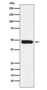 Anti-ERCC8 Rabbit Monoclonal Antibody Boster Bio