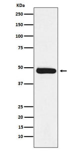 Anti-ERCC8 Rabbit Monoclonal Antibody Boster Bio