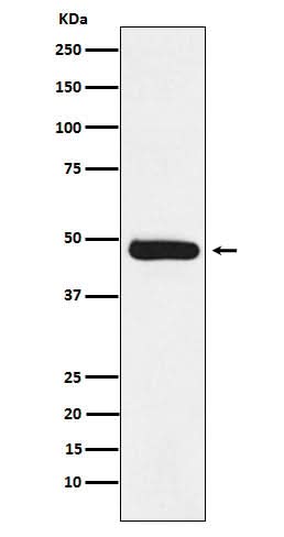 Anti-ERCC8 Rabbit Monoclonal Antibody Boster Bio