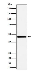 Anti-GNA13 Rabbit Monoclonal Antibody Boster Bio