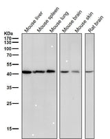Anti-CABP Rabbit Monoclonal Antibody Boster Bio